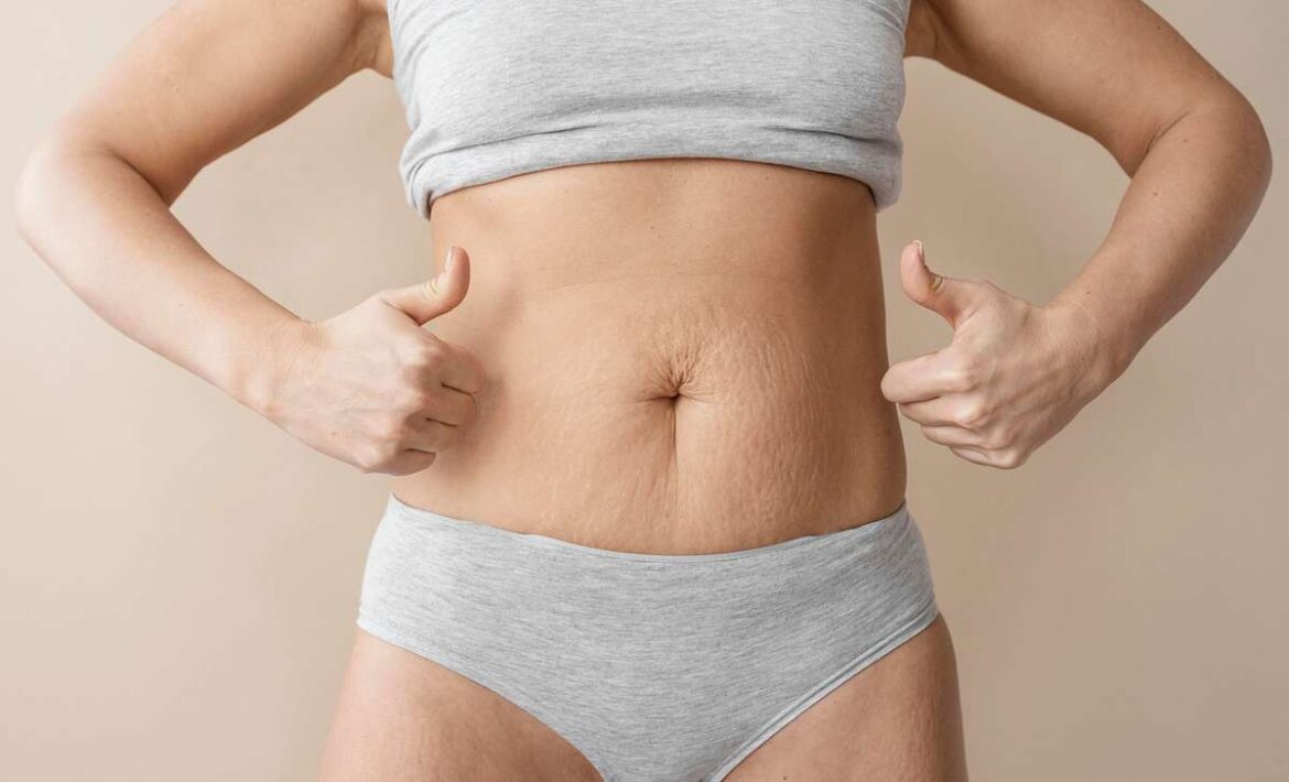 Metamorfoza Pani Eweliny – redukcja masy ciała -6kg w 3 miesiące